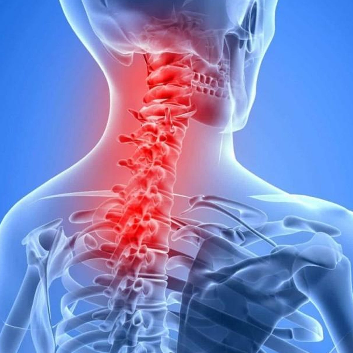 Neck Pain