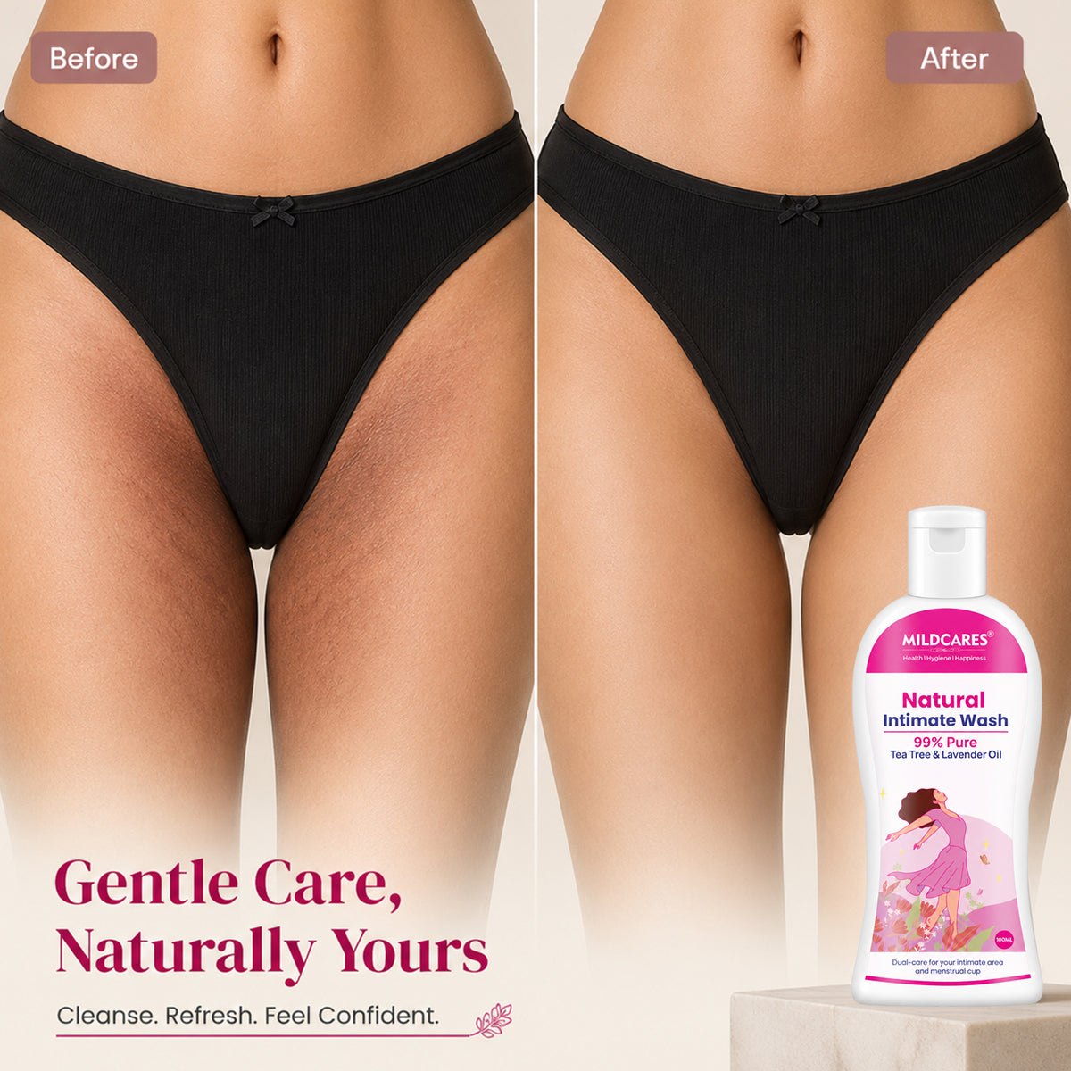MildCares Natural Intimate Wash : Keep Your Intimate Area Healthy And Fresh (Women)