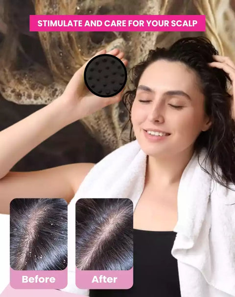 MildCares Hair Scalp Massager Brush For Hair Growth Shampoo Scrub Hair Massager Soft Silicone Head Massager Scalp Scrubber Exfoliator,Anti-Dandruff Hair Scalp Massager Brush