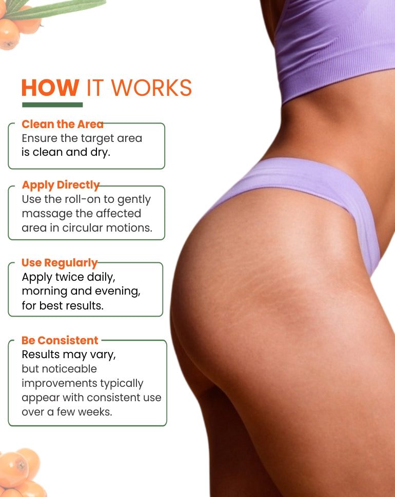 MildCares Stretch Marks Roll-On – Smooth, Nourish, and Revitalize Your Skin - 40ml