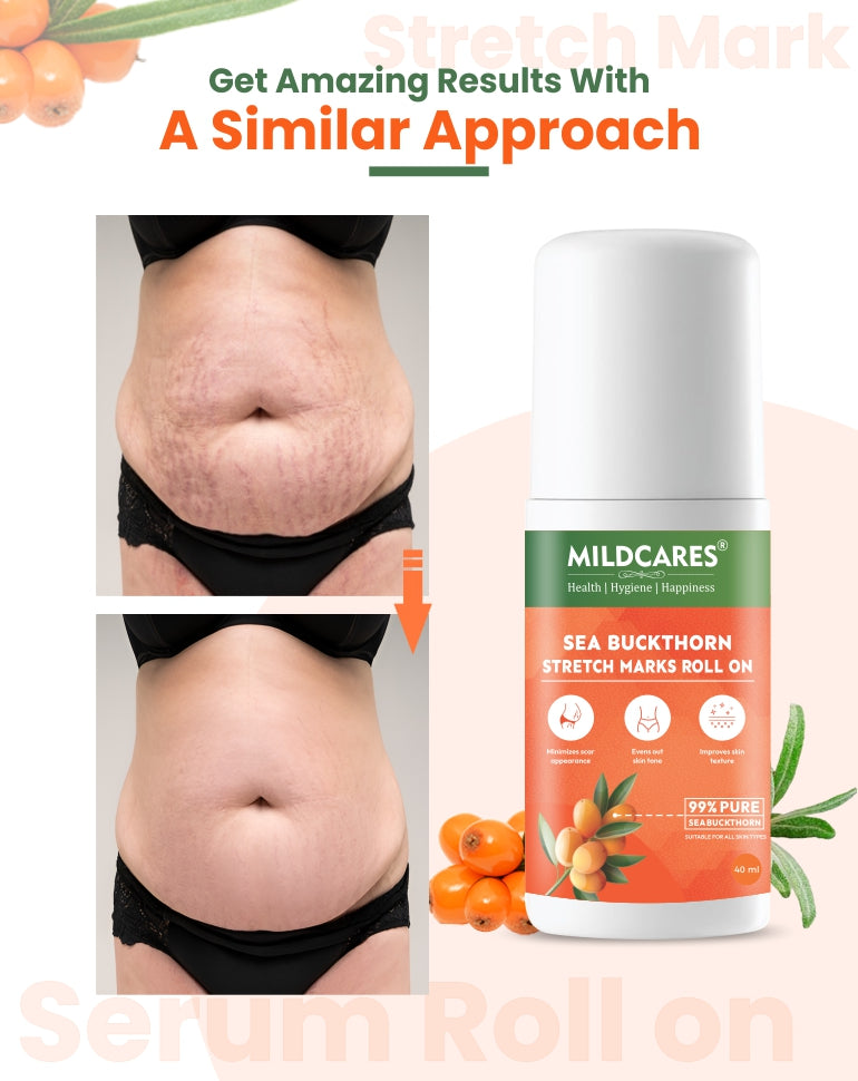 MildCares Stretch Marks Roll-On – Smooth, Nourish, and Revitalize Your Skin - 40ml