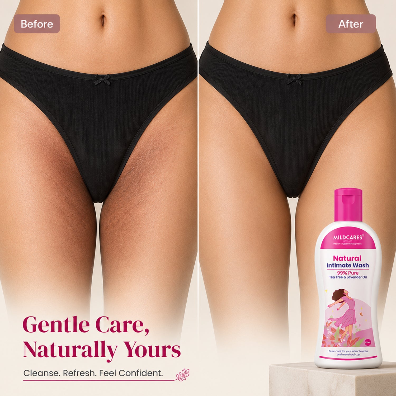 Women Intimate Care Wash : Keep Your Intimate Area Healthy And Fresh