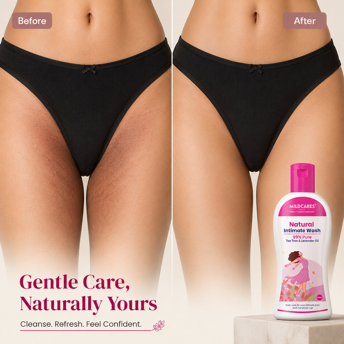 MildCares Natural Intimate Wash : Keep Your Intimate Area Healthy And Fresh (Women)